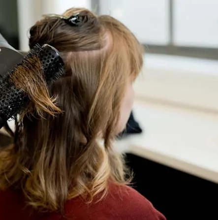 Alopecia femenina tratamiento caída del cabello mujer EMG