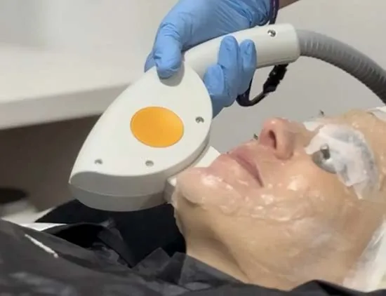 Uroginecología medicina estética femenina